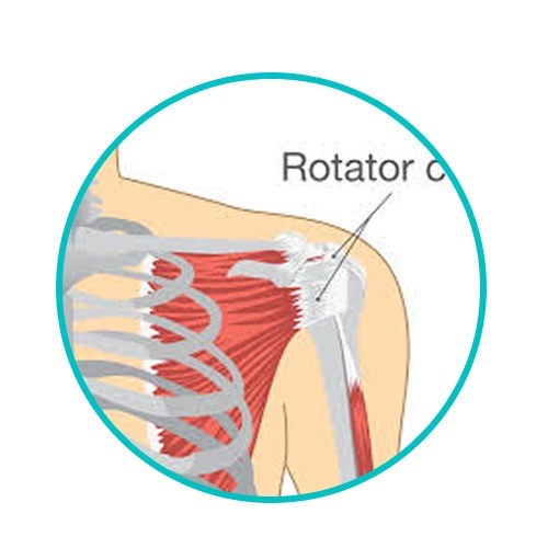 shoulder surgery